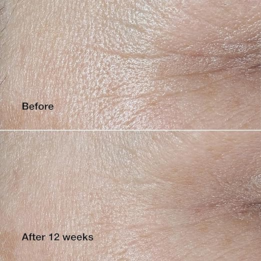 Clinique Smart Clinical Repair Wrinkle Correcting Cream 1.7oz - Curly Luxe