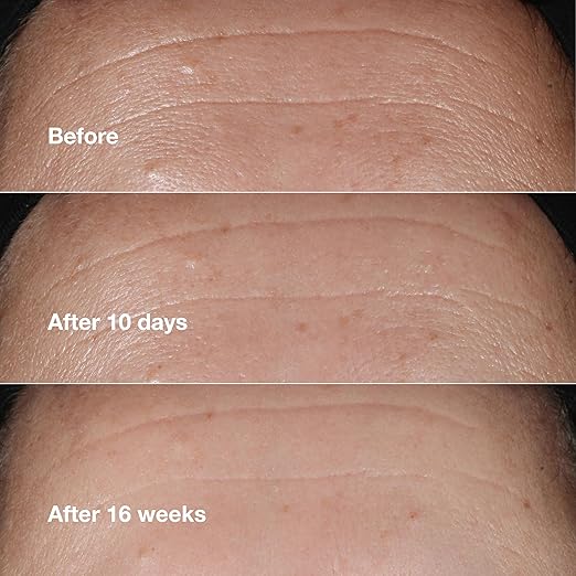 Clinique Smart Clinical Repair Wrinkle Correcting Serum 1oz - Curly Luxe