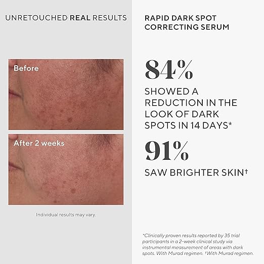 Murad Environmental Shield Rapid Dark Spot Correcting Serum 1oz - Curly Luxe