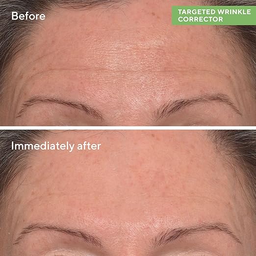 Murad Resurgence Targeted Wrinkle Corrector Treatment 0.5oz - Curly Luxe