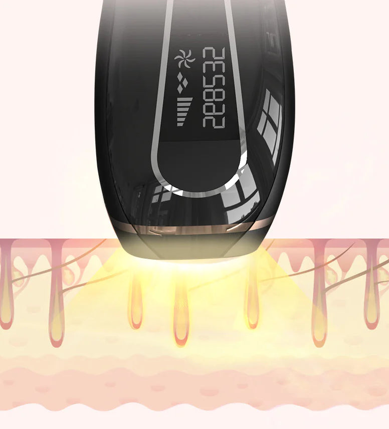 Home Laser Hair Removal Device for Full Body Care - Curly Luxe