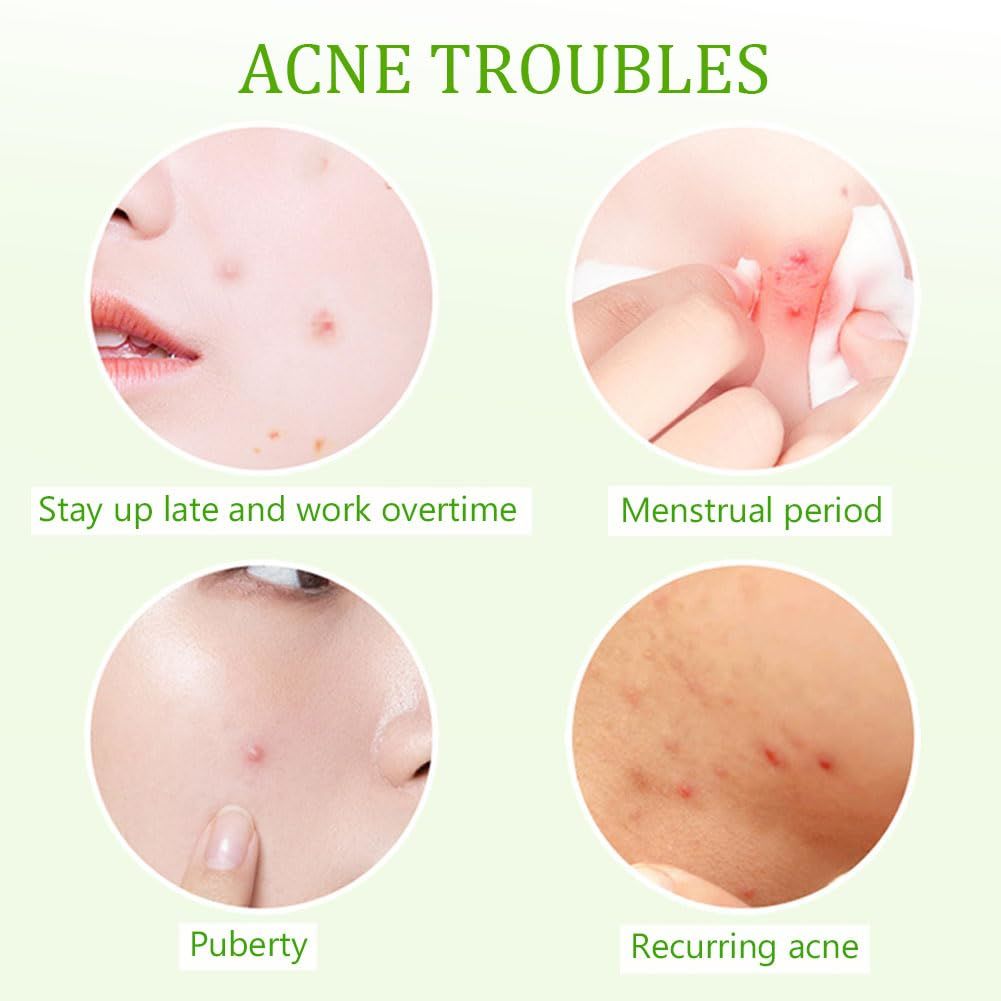 Pimple Patches for Face and Skin - Curly Luxe