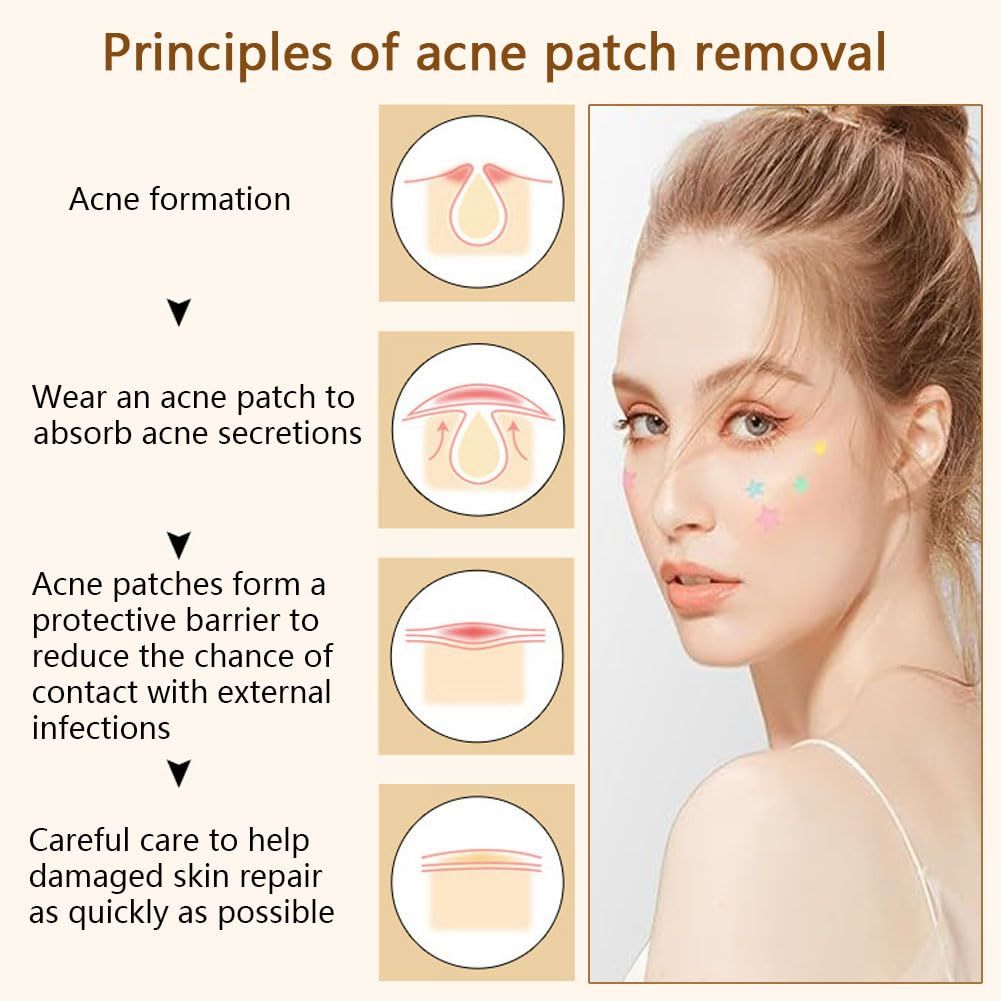 Pimple Patches for Face and Skin - Curly Luxe